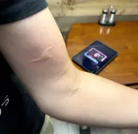 12 интересных случаев, когда с телом людей случилось что-то странное