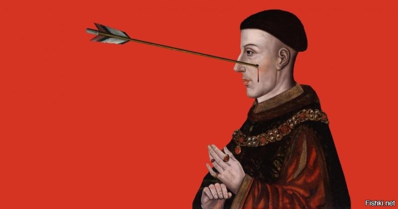 Король Генрих V получил в битве при Шрусбери, вытащили без анастезии. Выжил.