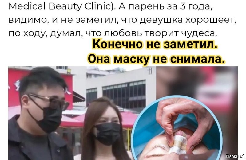 Миллион на силикон: как китаянка превратила парня своей подруги в спонсора "идеальных губ"