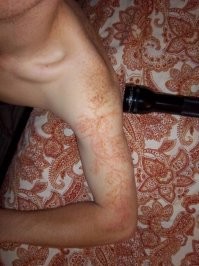 пустить по древесине высокое напряжение
.
А вот что будет, если пустить высокое напряжение от молнии по человечине.
 Лихтенбергу нраица.