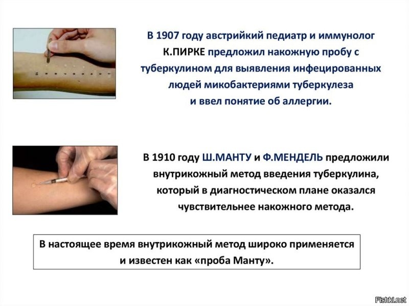 Не надо путать два разных теста. Нам в школе (в 80-е, в Ленинграде), делали и тот, и другой 

Основные отличия проб Манту и Пирке:
Проба Манту   внутрикожный тест, при котором раствор туберкулина вводится внутрикожной инъекцией.
Проба Пирке   накожный тест, в котором раствор туберкулина наносится на кожу скарификационно. В связи с тем, что кожа повреждена, место, на которое нанесён туберкулиновый состав, не рекомендуется мочить.
 
Таким образом, главное отличие в том, что при пробе Манту препарат вводится под кожу, а при пробе Пирке   на кожу, предварительно сделав на ней насечки, из-за чего вещество может смыться, и результат будет недостоверным.