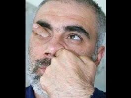 Убираем "зажим".