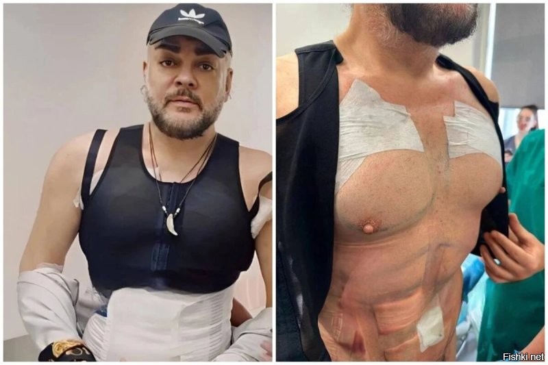 Как этот известный Румынский качёк...