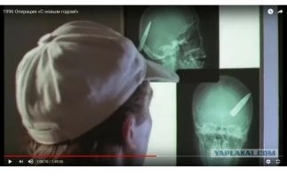 Ключ от машины застрял во лбу болельщика во время драки на матче