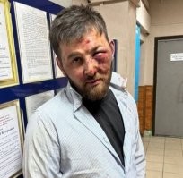 после встречи со спецназом