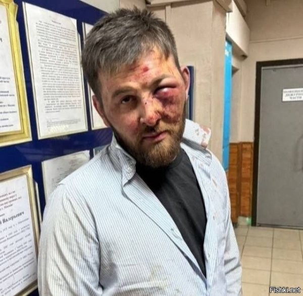 ЭТО в принципе жить не должно.
:butcher: