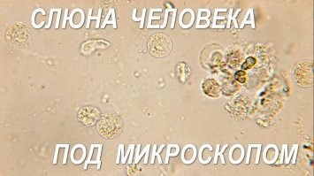 Тоже мало приятного.