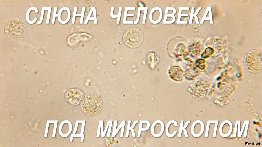 Тоже мало приятного.