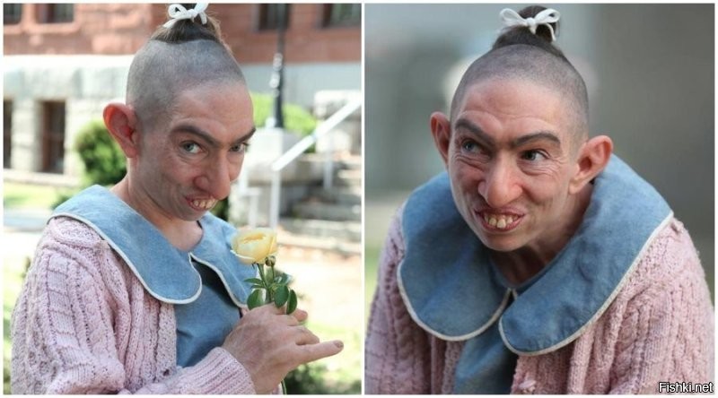 Как правильно использовать бальзам «Звёздочка»