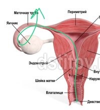 Давление большое было, пробило.