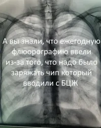 Раньше вроде флюорографию делали не чаще чем раз в два года или я ошибаюсь?