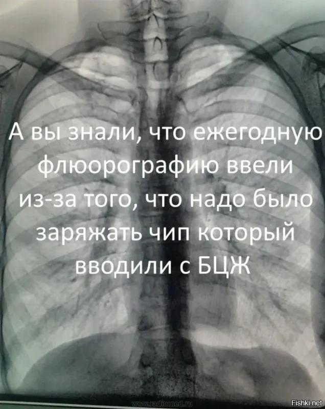 Раньше вроде флюорографию делали не чаще чем раз в два года или я ошибаюсь?