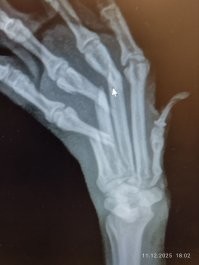 Боюсь там не только дикий шок. Вот Вам для примера последствие спрыгивания шпица со второй ступеньки в доме)))  3 пальца сломаны. А что у тех будет опосля такого полета с приземлением в руки- вообще вопрос.