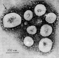 1. Газета от 1976 года

2. Скин из учебника по вирусологии 1989 года

3. Некоторая литература:

 - Закстельская Л. Я. и Щеболдов А. В. Коронавирусы человека и животных, М., 1977, библиогр.;
 - Mc Intоsh К. Coronaviruses, Curr. Top. Microbiol. Immunol., v. 63, p. 86, 1974; 
 - Tyrrell D. A. a. o. Coronaviruses, Nature (Lond.), v. 220, p. 650, 1968; 
 - Tyrrell D. A. a. o. Coronaviridae, Intervirology, y. 5, p. 76, 1975; 
 - Viral infections of humans, ed. by A. S. Evans, N. Y., 1976.

Живите теперь с этим
