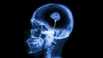 Без комментариев.