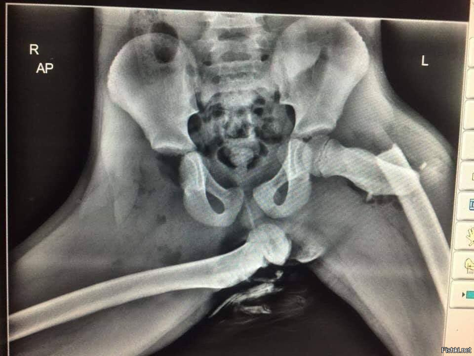 Вот наглядно.