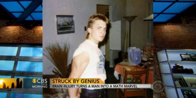 Джейсон Паджет попал в передрягу 12 лет назад. На него напали и жестоко избили, когда он выходил из бара.
До этого случая Паджет успел бросить колледж и, как он признавался, вёл жизнь, очень далёкую от интеллектуальной: в основном его интересы сводились к тому, чтобы подцепить в баре девчонку, покачаться в спортзале и погонять на мотоцикле.
Никакого интереса к точным наукам не было и в помине.
“Я был одним из тех, кто считал математику абсолютно бесполезным занятием”, – говорит он. 
Травма поменяла жизнь Паджета самым невероятным образом. Она сделала из него математического гения. Он даже написал об этом мемуары под названием “Удар гениальности: как травма мозга сотворила со мной математическое чудо”.
“В момент удара я увидел яркую вспышку белого света”, – рассказывает Паджет.
Несколько дней он провалялся в больнице, и только после выписки начал осознавать, как изменился для него окружающий мир.
“Сначала я списывал это странное состояние на обезболивающие, которые мне прописывали. Окружающие вещи я видел словно в рамах, которые покоились на движущихся облаках. Предметы утратили прежние очертания и теперь больше походили на графики и схемы”.
Доктора говорят, что после травмы Паджет получил доступ к той области мозга, которая обычно недоступна нашему сознанию.
“Капли дождя я теперь вижу как прекрасный переплетающийся узор. Маленький клубок переплетённых линий. Гладкость исчезла отовсюду. Даже раскачивающиеся деревья преобразуются в уравнения. Это как если написать уравнение и перевести его в график. Изменение переменной меняет кривую графика”.
“В моей голове поселились геометрические построения, – продолжает Паджет. – Я видел их всюду. Я почувствовал, что должен вернуться к учёбе и одолеть школьный курс математики, чтобы затем писать свои уравнения”.
“Подобными способностями обладает каждый из нас, – считает Паджет. – Мы все неосознанно выполняем сложные математические и физические вычисления: если кто-нибудь бросает вам мяч, то вы каким-то образом высчитываете и воздействующее на него гравитационное поле, и множество других факторов, благодаря чему и ловите этот мяч. Если бы вы смогли записать уравнение, которое в этот момент решает ваш мозг, то поразились его сложности. Но вы просто ловите его автоматически, не задумываясь”.
Фото до и после: