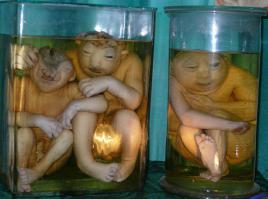 Вот эти - чисто алкаши с нашего двора. - Эй, приэт, слышь это, подкинь малёха па-саседски на пивас.