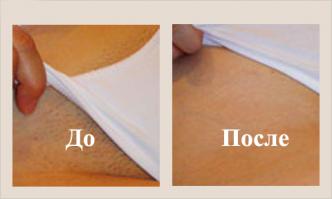 8 полезных альтернативных способов применения скотча