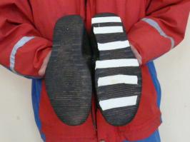 Бабушкин и мамин способ - лейкопластырь!