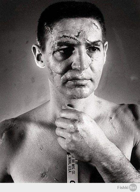 Терренс Гордон (Терри) Савчук даже после того как все хоккейные вратари стали использовать маски, он продолжал играть без защиты, и впервые одел ее лишь в 1962 году. К тому времени все его лицо было покрыто рубцами и шрамами, их было около четырех сотен.