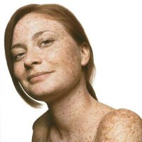 Веснушки на лице это мило ;)
Но таки как насчет вот этого: