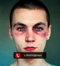 Легкий способ получить рану