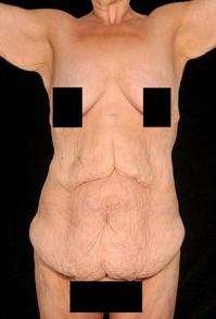 Гламурная модель вдохновила свою старшую сестру похудеть на 67,5 кг