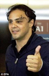 Безапастность пилота в F-1