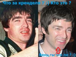 До и после стоматолога