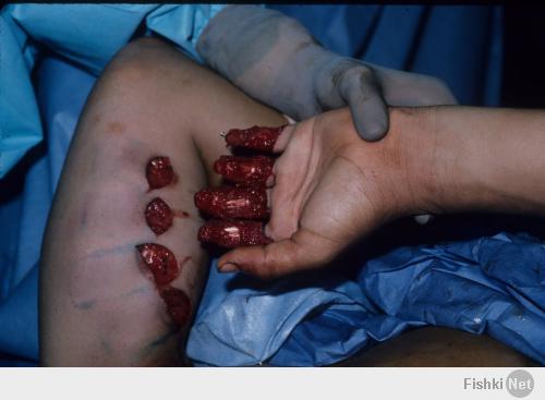 Он знает технику безопасности как свои 3 пальца!