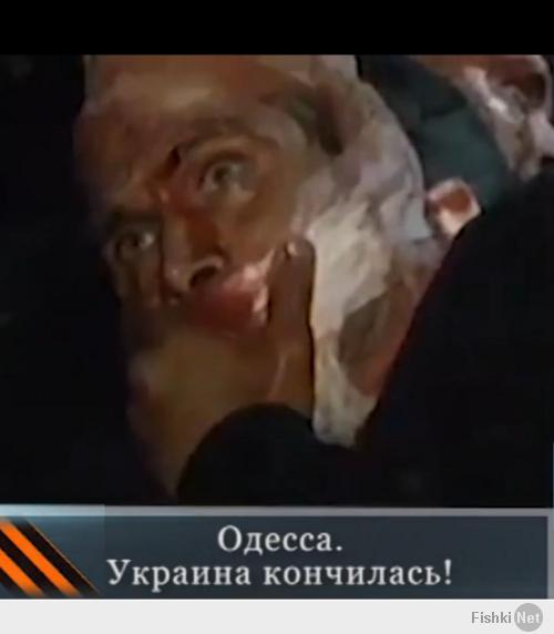 Я отвечу - людей живьем жгут.