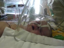 Слёзы на глаза наворачиваются, бедные детки! Сама через такое прошла, 3 месяца реанимации без всяких гарантий.. Но слава богу спасли. Желаю всем родителям в подобной ситуации не унывать и верить в лучшее!