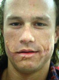 Снимал несколько дней, как заживает рана