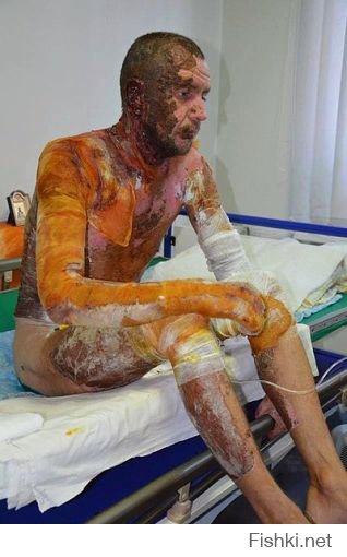 Вчера их призывали как героев, обещали деньги за убийство мирного населения, а сегодня они никому не нужны. А сколько зарыто без табличек в донецкой степи, потому, что их просто не хотят забирать, чтобы семьям компенсацию не выплачивать.