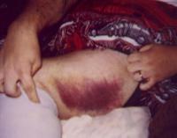 На байке, без защиты.