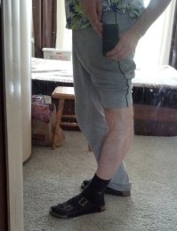 Последняя фото абсолютно реальная, у меня так-же гнутся. Передалось по материнской линии мне и третьему брату. Просто повышенная подвижность сустава, никаких проблем не доставляет.
Вот вам на максимум выгнул, без всяких фотошопов, только отмасштабировал в паинте.