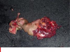 Похоже фрагмент трупа. Вот сочнее -