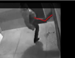 он сломал ногу что ли??