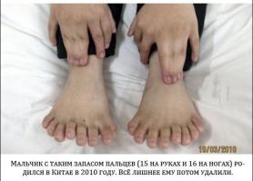 ога, родился в 2010-ом сразу в штанах и шестилетним и тут же после родов сделали снимок))