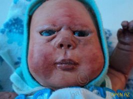 Британка не улыбалась 40 лет из-за боязни морщин