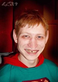 ИНТЕРЕСНЫЕ ФАКТЫ О ЛЮДЯХ С РЫЖИМ ЦВЕТОМ ВОЛОС