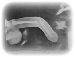 Ад перфекциониста