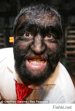 Ээээ, да! 

"Белый негр" - Wolf boy, мексиканский цирковой артист, участник фрик-шоу. У него гипертрихоз, т.е. сверхволосатость.

На фото он поднимается босиком по лестнице из сабель.