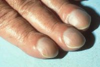 Или врожденное