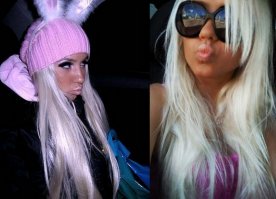 Симптом "хоботка" — проявление манерности при шизофрении.