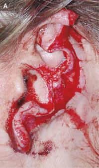 Сказать что ПИТБУЛИ это "Самые ласковые" собаки в мире, все равно что сказать что крысы самые полезные в хозяйстве животные.
Питбули это ОПАСНЫЕ БОЙЦОВСКИЕ СОБАКИ, с очень неуравновешенной психикой и как бы вы его хорошо не воспитывали/любили у них в генах есть приличный % "брака" от которого у них едет крыша. Как по мне так владение такими зверями нужно приравнивать к оружию и выдавать хозяевам соответствущие разрешения дабы они несли за них полную ответственность.

P.S-А по поводу "Лассковых" итд, расскажите это РОДИТЕЛЯМ детей на фотках приведенных мною ниже, это лишь ОЧЕНЬ МАЛАЯ ЧАСТЬ жертв "Самых ласковых собак" в мире.По нападению на детей/людей собака твердо занимает место в ТОП-5 среди пород.