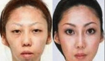 а потом у красивой пары чудные дети, они итак могут быть чудными, но в случае такого обмана вероятность-то больше ) Предупреждать надо.