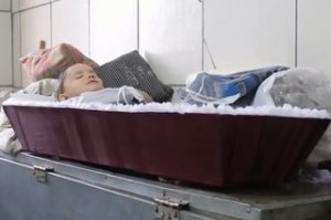 06.02.15. Репортаж от журналистов. 

"Когда я достал сына, он уже не дышал…" — трагедия одной донецкой семьи. ?В конфликте на Донбассе почти ежедневно гибнут ни в чём не повинные люди. Для одной семьи из Донецка жизнь уже никогда не станет прежней. Тамара и Владимир Бобрищевы рассказали корреспонденту RT Роману Косареву о самом страшном дне в их жизни.Кадры, которые показаны в сюжете корреспондента RT, житель Донецка Владимир Бобрищев снял на мобильный телефон. Это всё, что осталось от его дома. В результате артобстрела погиб его 4-летний сын Артём. Старший, 7-летний Миша, получил тяжёлое ранение. Жена Владимира Тамара потеряла правую ногу. Она говорит, из-за этого не смогла спасти своего ребёнка.

«Если бы не нога, я бы его спасла. Я не могла просто встать и откопать его полностью. Я очень кричала, никто не пришёл. Хотя тут были те, кто мог спасти. Потом уже муж прибежал», — говорит Тамара.

По Донецку била тяжёлая артиллерия, и врачи просто не смогли добраться до семьи Владимира.

«Скорую мы ждали и не дождались. Нас эвакуировали ополченцы в грузовой машине. Откачивали, но не откачали, он задохнулся. У него не было ни ушибов, ничего — просто задохнулся», — продолжает женщина.

Когда начался обстрел, Владимир подходил к своему дому. Прямо на его глазах в дом попал снаряд.

«Сразу на входе был сын, у него сильно рассечена была голова, кровь текла, глаз был открытый полностью. Я его выкопал быстро, замотал в куртку и отнёс в погреб, потому что ещё обстрелы сыпались в этот момент. Потом уже нашёл жену. Я её тоже откопал, а она кричала, что сын ещё дышит. Когда я его достал, ребёнок уже не дышал», — рассказывает Владимир.

Младшего сына Артёма семья уже похоронила. Теперь они надеются, что старший сын не останется инвалидом на всю жизнь. У Миши осколочные ранения лица и тела. Мальчику сделали две операции, и он говорит, что ему уже не больно. Но ему нужна ещё одна, которую в Донецке не делают. Благотворительная организация готовит Мишу к отправке в Москву, где он получит необходимое лечение.

Но здесь, в Донецке, ещё много семей, переживших такие же трагедии. И им некуда идти." Спасибо Россия за навязанные нам минские соглашения и вот перемирие ! Минусуйте сколько хотите . А укропов надо только уничтожать а не переговариваться под нажимом сша.