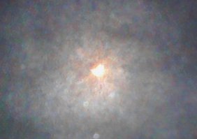 А вот мое! Через рентген позвоночника